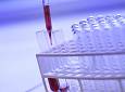Coronavirus: in Toscana screening di massa per capire chi ha già gli anticorpi